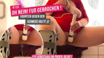 OH NEIN! Fuß gebrochen! – Squirten gegen den Schmerz hilft! ;D