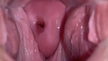 Untersuchung des Gebärmutterhalses. Was ist los mit meiner Vagina?