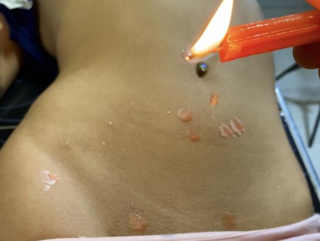 MEINE ERSTE ERFAHRUNG mit HOT WAX, Tropfen der Freude auf meinem Körper