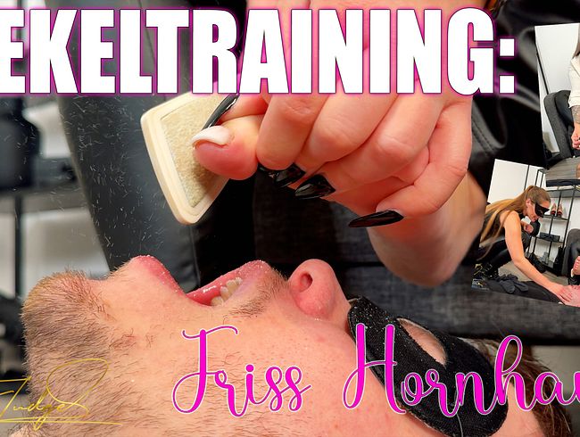 Ekeltraining: Friss Hornhaut!